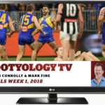 Footyology TV – Monday 10th September 2018